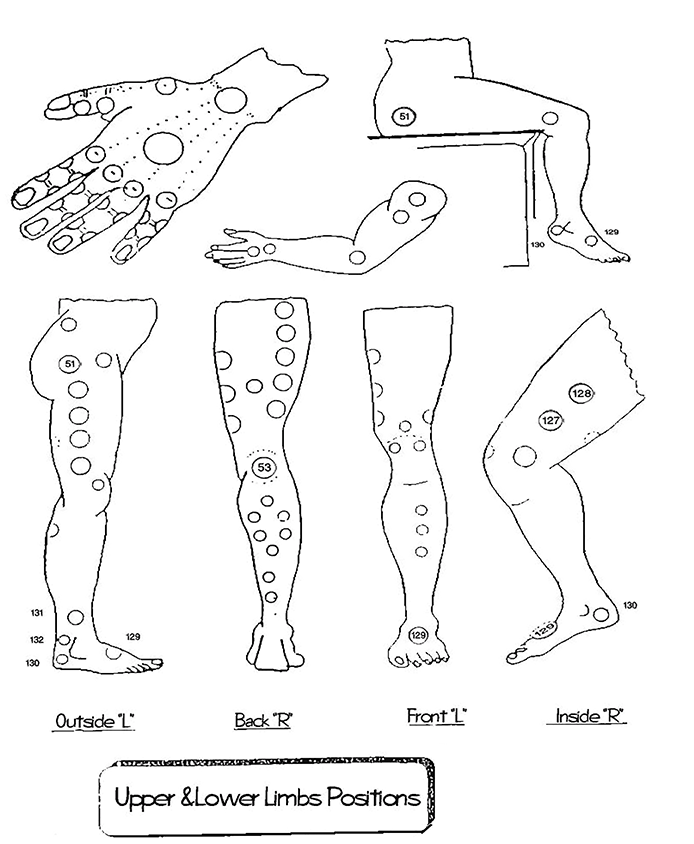 How to Locate Hijama / Cupping Points on the Legs Hijama Points